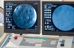 Angiographie_Fotolia_48440159_M_Alterfalter_thumbnail_ger.jpg